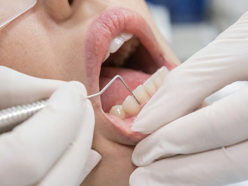 Πόσο συχνά πρέπει να μας βλέπει ο οδοντίατρος;